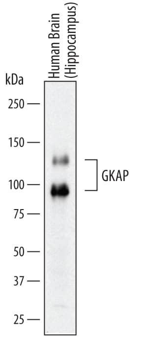 Detection of Human GKAP/DLGAP1 antibody by Western Blot.