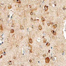 GKAP antibody in Human Brain by Immunohistochemistry (IHC-P).