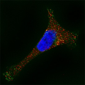 a-Galactosidase A/GLA antibody in HeLa Human Cell Line by Immunocytochemistry (ICC).