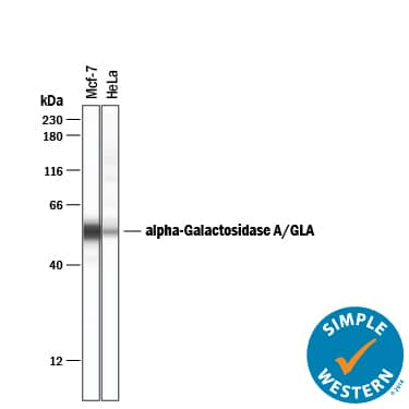 Detection of Human a-Galactosidase A/GLA antibody by Simple WesternTM.
