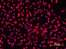 GLI-1 antibody in HeLa Human Cell Line by Immunocytochemistry (ICC).