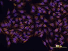 GLI-3 antibody in HeLa Human Cell Line by Immunocytochemistry (ICC).