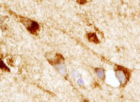 GLP-1R antibody in Human Brain by Immunohistochemistry (IHC-P).