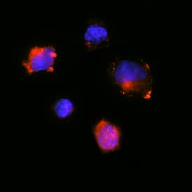 GM-CSF antibody in Rat Splenocytes by Immunocytochemistry (ICC).