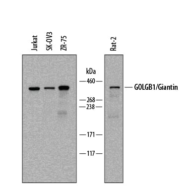 Detection of Human and Rat GOLGB1/Giantin antibody by Western Blot.