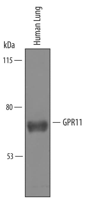 Detection of Human GPR111 antibody by Western Blot.