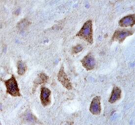 GPR12 antibody in Human Brain by Immunohistochemistry (IHC-P).