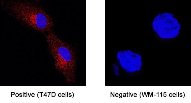 GPR56 antibody in T47D human breast cancer cell line by Immunocytochemistry (ICC).