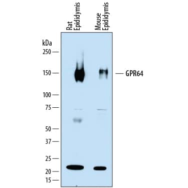 Detection of Rat and Mouse GPR64 antibody by Western Blot.