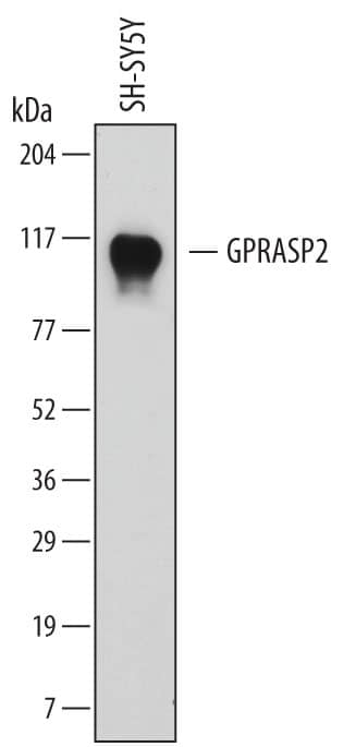 Detection of Human GPRASP2 antibody by Western Blot.