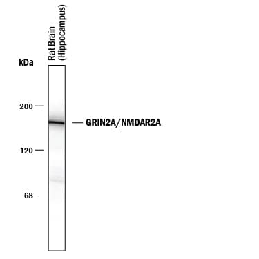 Detection of GRIN2A/NMDAR2A antibody by Western Blot.