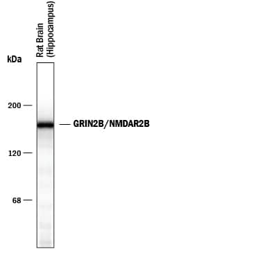 Detection of GRIN2B/NMDAR2B antibody by Western Blot.