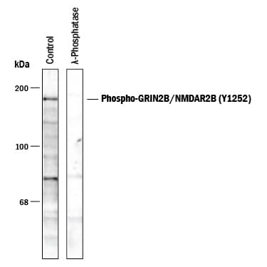 Detection of GRIN2B/NMDAR2B (Y1252) antibody by Western Blot.