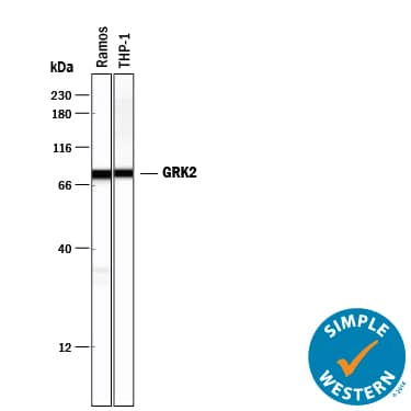 Detection of Human GRK2 antibody by Simple WesternTM.
