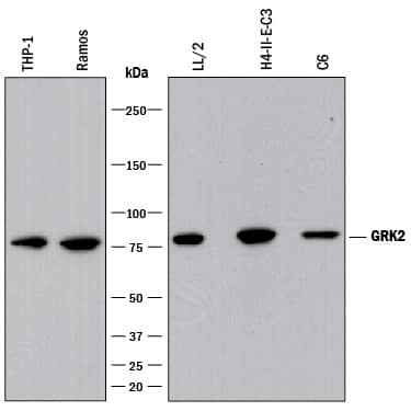 Detection of Human, Mouse, and Rat GRK2 antibody by Western Blot.