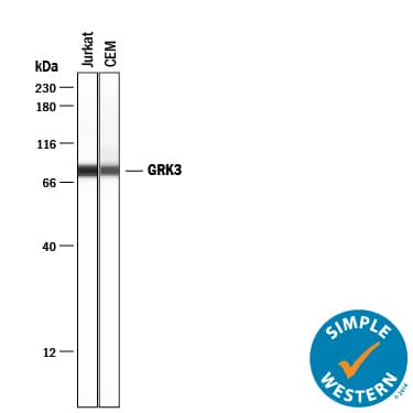Detection of Human GRK3 antibody by Simple WesternTM.
