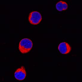 GRK3 antibody in CEM-NKr Human Cell Line by Immunocytochemistry (ICC).