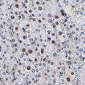GR/NR3C1 antibody in Human Liver by Immunohistochemistry (IHC-P).