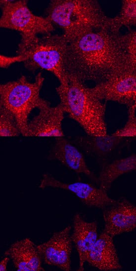 Phospho-GSK-3 beta (S9) antibody in HeLa Human Cell Line by Immunocytochemistry (ICC).