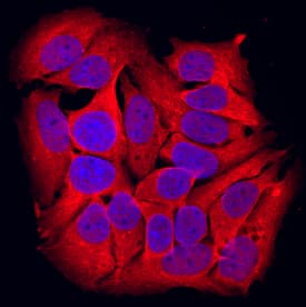 GSK-3a antibody in MCF-7 Human Cell Line by Immunocytochemistry (ICC).