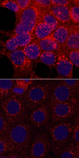 Phospho-GSK-3 beta (S9) antibody in MCF-7 Human Cell Line by Immunocytochemistry (ICC).