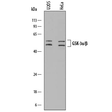 Detection of Human GSK 3a and GSK-3 beta antibody by Western Blot.