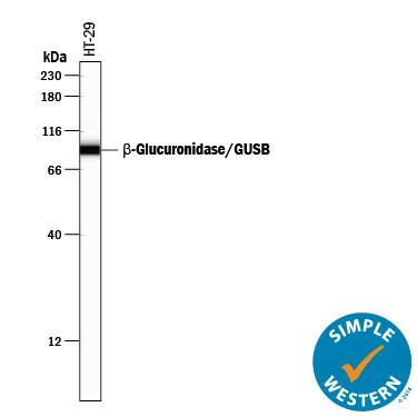Detection of Human  beta-Glucuronidase/GUSB antibody by Simple WesternTM.