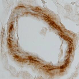 Galanin R2 in Human Brain. Galanin R2 antibody in Human Brain by Immunohistochemistry (IHC-P).