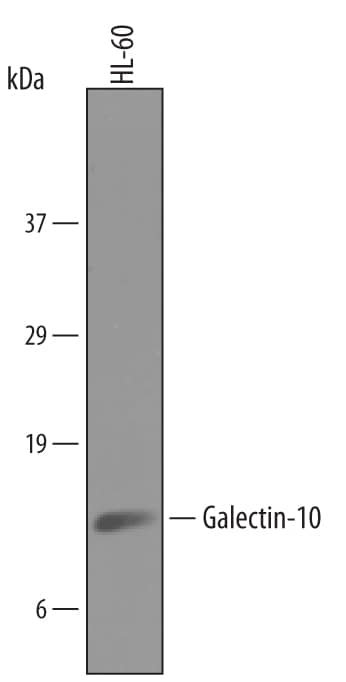 Detection of Human Galectin-10 antibody by Western Blot.