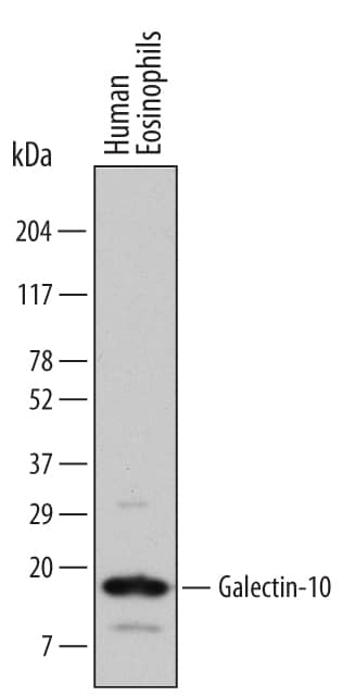 Detection of Human Galectin-10 antibody by Western Blot.
