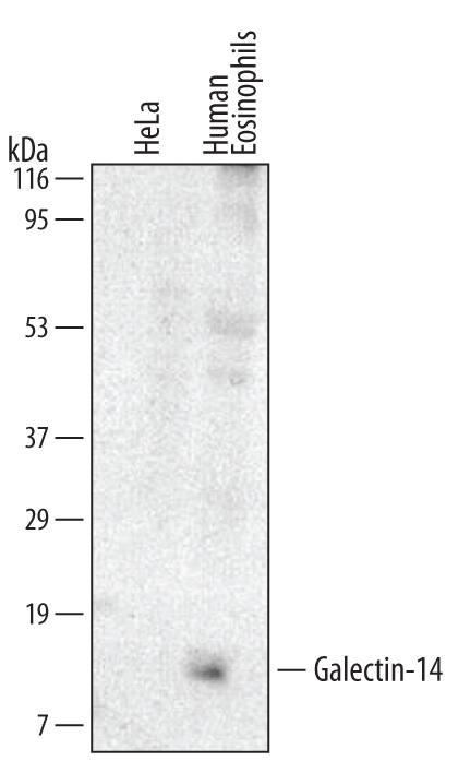 Detection of Human Galectin-14 antibody by Western Blot.