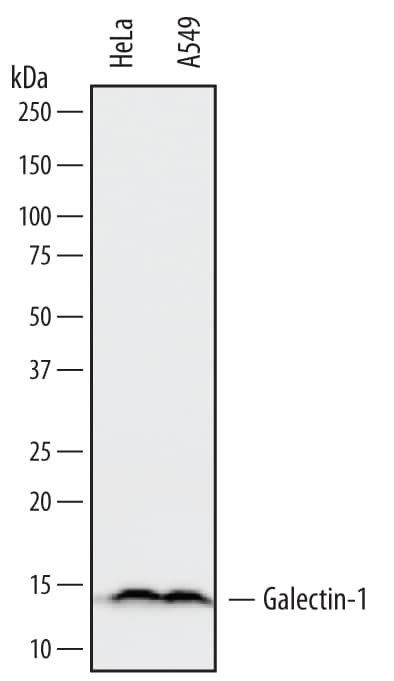 Detection of Human Galectin-1 antibody by Western Blot.