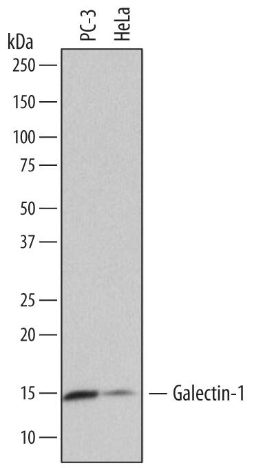 Detection of Human Galectin-1 antibody by Western Blot.