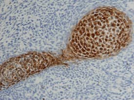 Galectin-3 antibody in Mouse Cartilage by Immunohistochemistry (IHC-Fr).