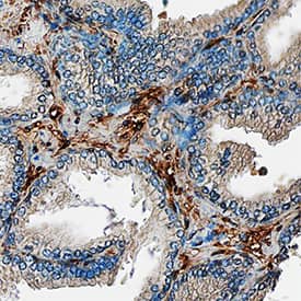 Galectin-1 antibody in Human Prostate by Immunohistochemistry (IHC-P).