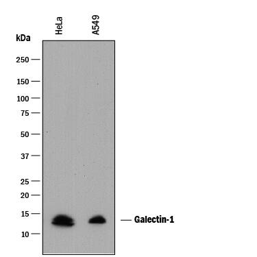 Detection of Human Galectin-1 antibody by Western Blot.