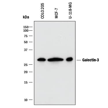 Detection of Human Galectin-3 antibody by Western Blot.