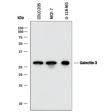 Detection of Human Galectin-3 antibody by Western Blot.