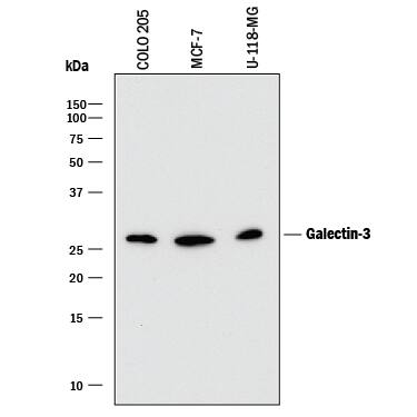 Detection of Human Galectin-3 antibody by Western Blot.