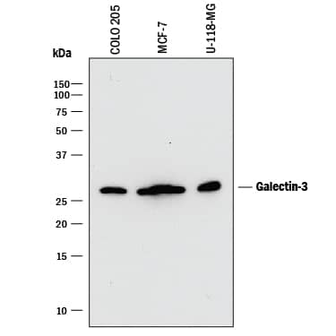 Detection of Human Galectin-3 antibody by Western Blot.