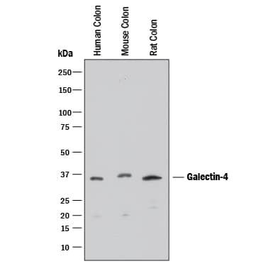 Detection of Human, Mouse, and Rat Galectin-4 antibody by Western Blot.