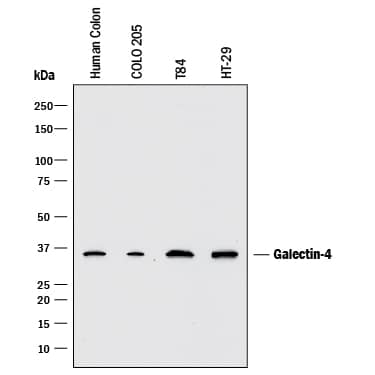 Detection of Human Galectin-4 antibody by Western Blot.