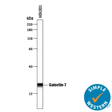Detection of Human Galectin-7 antibody by Simple WesternTM.