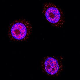 Galectin-7 antibody in HEK001 Human Cell Line by Immunocytochemistry (ICC).