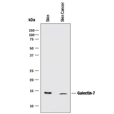 Detection of Human Galectin-7 antibody by Western Blot.