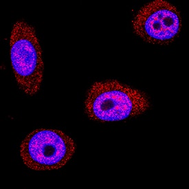Galectin-7 antibody in HEK001 Human Cell Line by Immunocytochemistry (ICC).