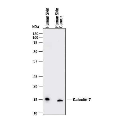 Detection of Human Galectin-7 antibody by Western Blot.