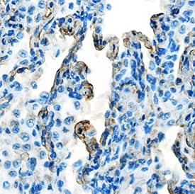 Galectin-8 antibody in Human Lung by Immunohistochemistry (IHC-P).