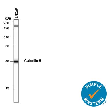 Detection of Human Galectin-8 antibody by Simple WesternTM.