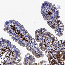 Galectin-9 antibody in Human Colon by Immunohistochemistry (IHC-P).